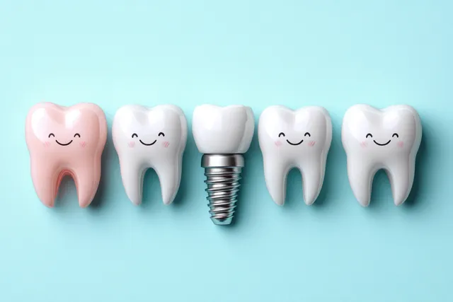 Five smiling teeth characters with one dental implant on light blue background with Clean Medical Icon Style