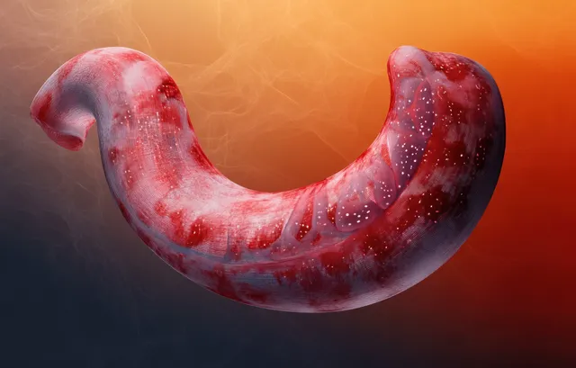 A surreal red stomach illustration with glittering specks floats against an orange dark gradient background.